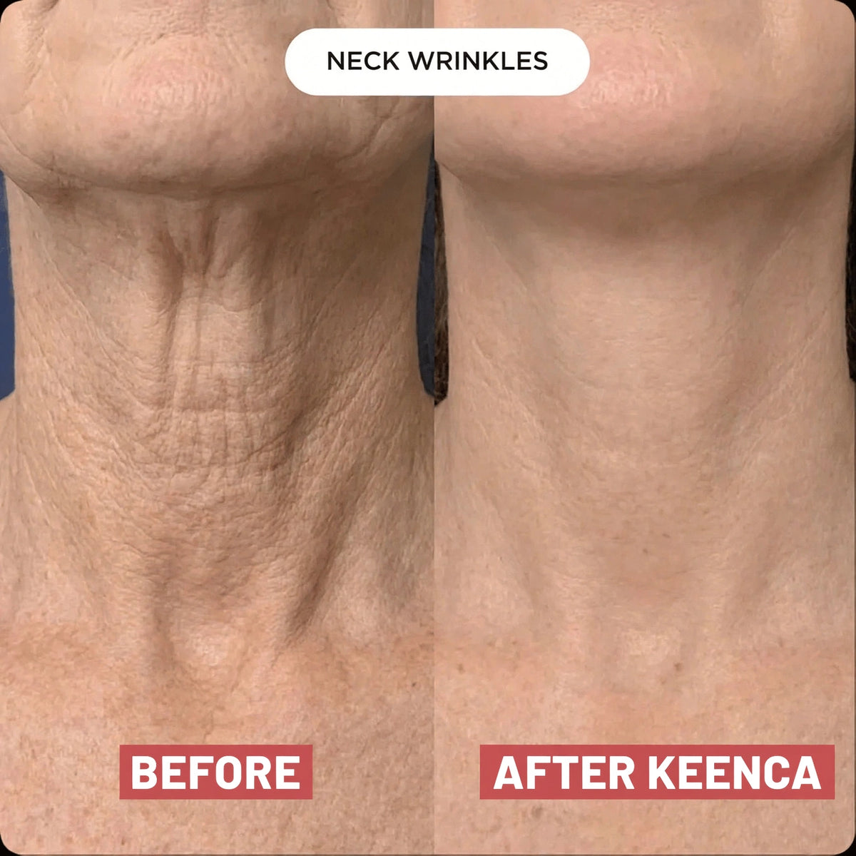 Keenca - Neck beauty patch
