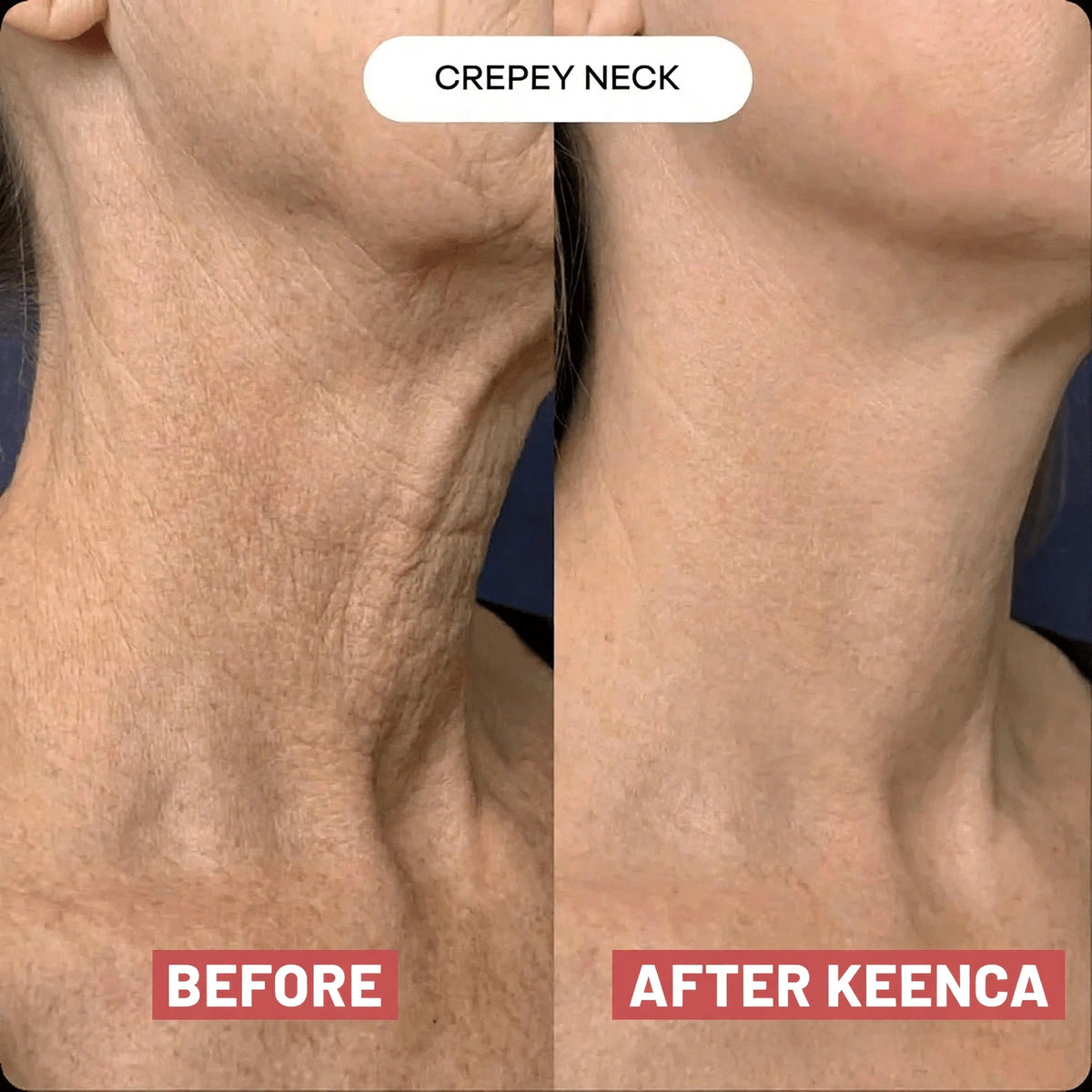 Keenca - Neck beauty patch